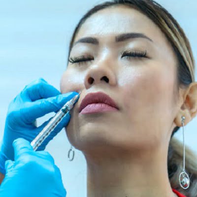 Injecting collagen to face