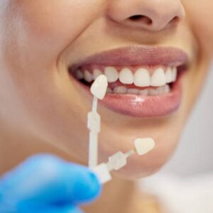 Are there 2 types of veneers in Islamabad?