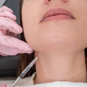 Does Double Jaw Surgery Change Your Face Shape?