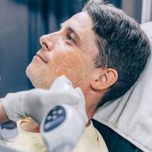 How Long Does Pico Laser Treatment Take?