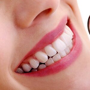 How Long Will Teeth Stay White After Whitening Treatment Done?
