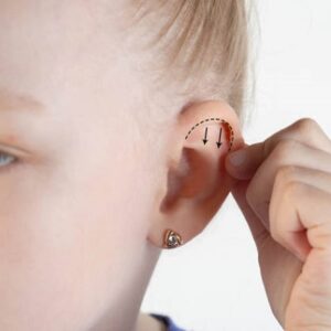 How can I find the best clinic for ear lob surgery in Islamabad?