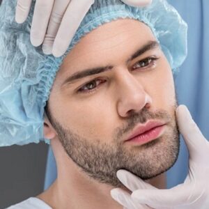 What is the best type of beard transplant in Islamabad?