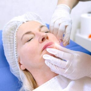 Where to Find Fine Line Removal Services in Islamabad?