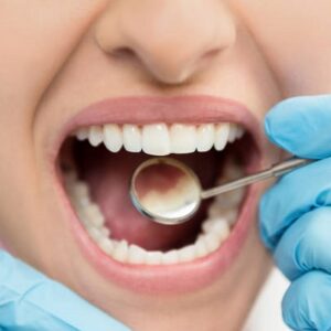 Which Crown Is Best for Teeth in Islamabad?