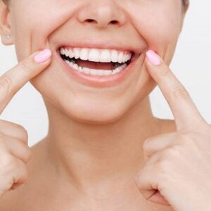 Which type of veneer is best?