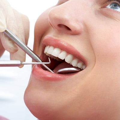 Choosing the Best Dental Filling for Teeth in Islamabad