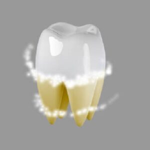 Do Teeth Continue to Whiten After Laser?