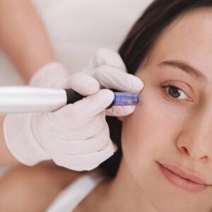 How Do Microneedling Results Last?
