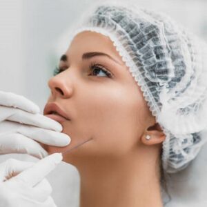 How Does a Thread Lift Affect Collagen Production?