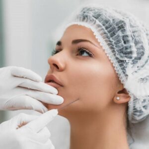 How Many Threads Do I Need for A Full-Face Thread Lift?