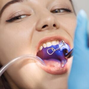 How long does it take for a gum graft to heal?