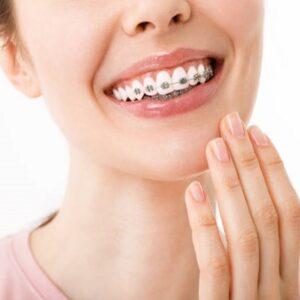 How to Choose the Right Orthodontist in Islamabad