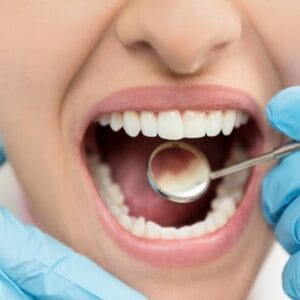 What Is the Safest Type of Crown in Islamabad?