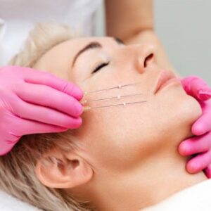 What is the best type of thread lift?