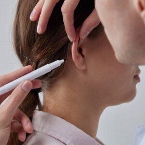 What to Expect from Ear Reshaping Surgery