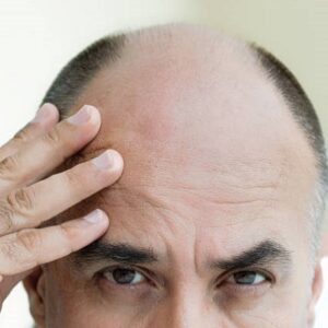 Which type of hair transplant is best?