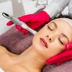 Can I Do Microneedling After Every 2 Months?