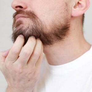 Does Hair Grow Back After Beard Transplant?