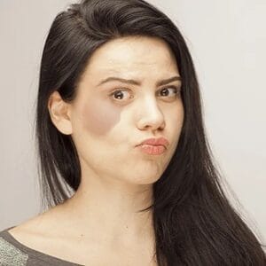 How many treatments for birthmark removal in Islamabad?