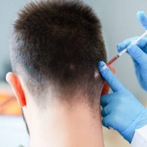 Is PRP Treatment 100% Effective?