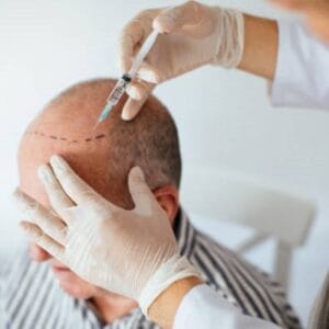 Which hair transplant is safe?