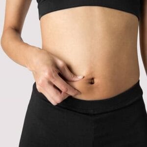 Can fat be removed during a tummy tuck?