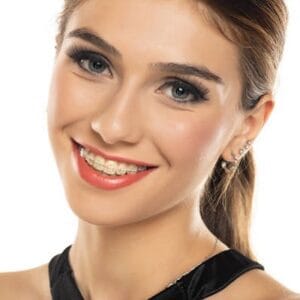 Do braces fix teeth permanently?