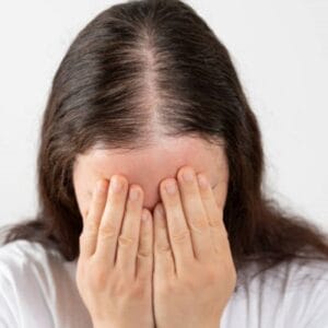 What Is the Big 3 Hair Loss Treatment in Islamabad?