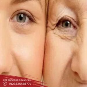 anti aging treatment in Islamabad