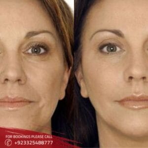anti aging treatment (2)