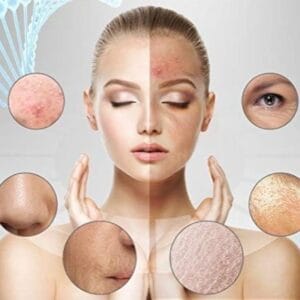 Best Non-Invasive Skin Whitening Treatments in Islamabad