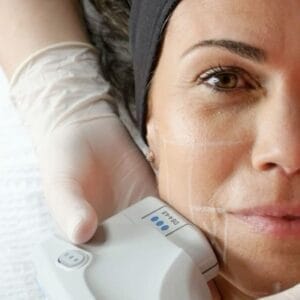 Does HIFU Slim Your Face?