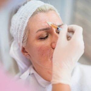 Does skin get darker after microneedling?