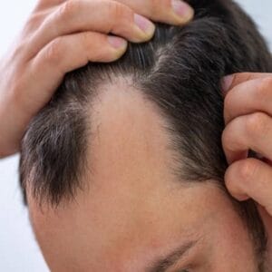 How Can New Treatments Improve Hair Regrowth?