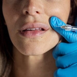 How Dermal Fillers Can Boost Your Confidence Instantly