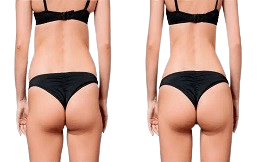 Body Fillers cost in Islamabad