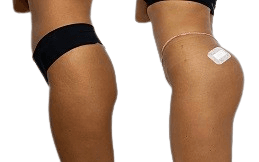 Body Fillers in Islamabad