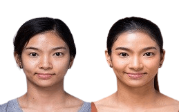 IV drip therapy before after in Islamabad