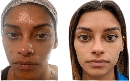 IV_drip_therapy_in_Islamabad