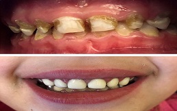 Pediatric Dentist in Islamabad