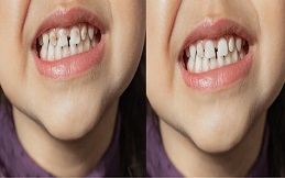 Pediatric Dentist before after in Islamabad