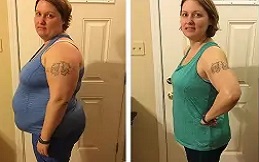 Bariatric Surgery cost in Islamabad