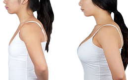 Breast Enhancement Surgery cost in Islamabad
