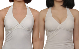 Breast Enhancement Surgery in Islamabad