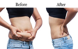 How to Lose Belly Fat before after in Islamabad