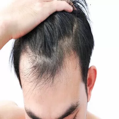 Front Line Hair Fixing cost in Islamabad