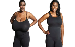 Breast Reduction Surgery cost in Islamabad