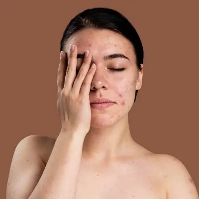 Scar Removal in Islamabad