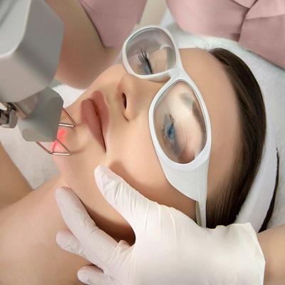 Fractional CO2 Skin Resurfacing in Islamabad